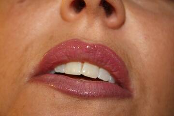 kiss2